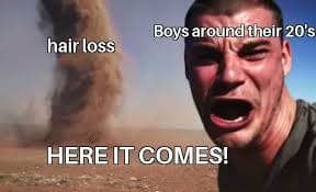 My hair transplant experience (before & after)